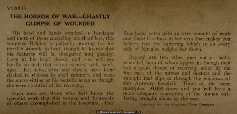 Ghastly Glimpse of Wounded Belgians in Hospital Antwerp Belgium (3d, Antwerp, Belgian, Belgium, C1915, Hospital, Nurse, Wounded, WW1)