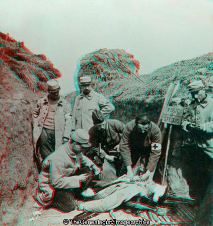 Rendering First Aid to the Wounded in the French Trenches (3d, C1917, first aid, French, Soldiers, Stretcher, Trench, WW1)